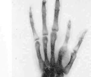 AI in Radiology: Past, Present, and Future Innovations - medtigo Journal